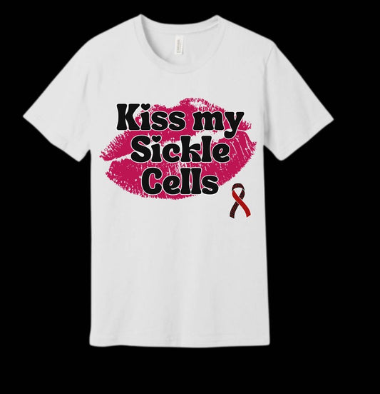 Kiss my Sickle Cells